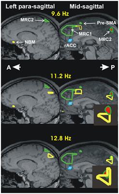 Neurofeedback and the Neural Representation of Self: Lessons From Awake State and Sleep